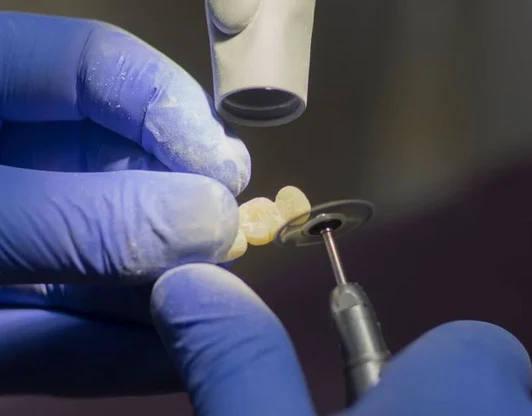 Протезирование